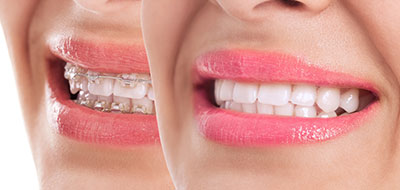 The image features a woman smiling with her mouth open, showcasing her teeth, and there s a close-up photo of her face on the right side of the image.