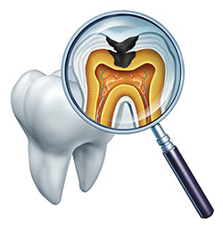 A digital illustration depicts a magnified view of a tooth with an X-ray image revealing its internal structure, including roots and pulp, superimposed on the front surface.