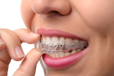 The image features a person holding a toothbrush with an Invisalign aligner on their teeth, showcasing the product being used for dental alignment.