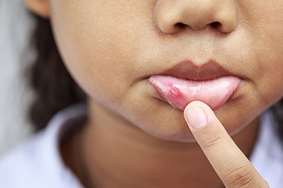 A young girl with a finger on her lips, examining her skin with concern.