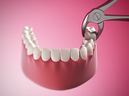 Alvin Jacobs, DDS